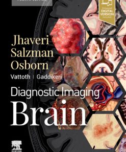 Diagnostic Imaging: Brain, 4th Edition (ePub+Videos)