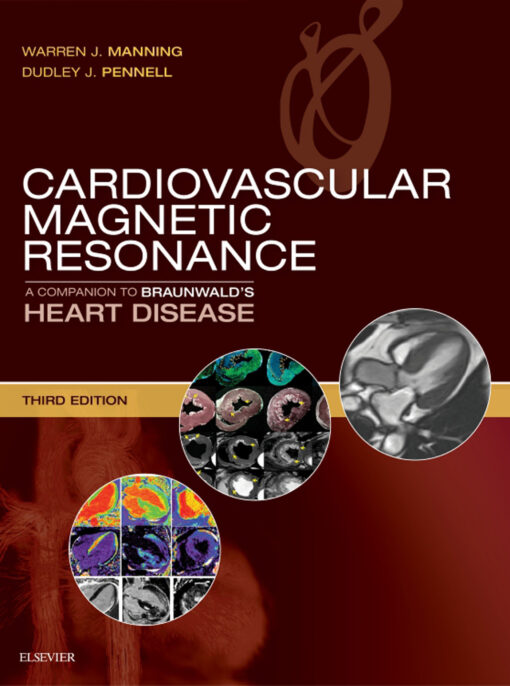 Cardiovascular Magnetic Resonance: A Companion to Braunwald’s Heart Disease, 3rd Edition (ePUB) Cardiovascular Magnetic Resonance: A Companion to Braunwald’s Heart Disease, 3rd Edition (ePUB)