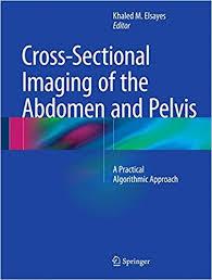 Cross-Sectional Imaging of the Abdomen and Pelvis: A Practical Algorithmic Approach