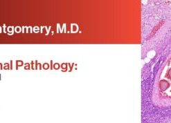 Expert Series with Elizabeth Montgomery, M.D.: Gastrointestinal Pathology: A One-On-One Tutorial 2021 (CME VIDEOS)