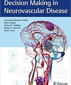 Decision Making in Neurovascular Disease 1st Edition