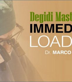 Degidi MasterClass: Immediate Loading