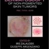 Dermatoscopy of Non-Pigmented Skin Tumors: Pink – Think – Blink