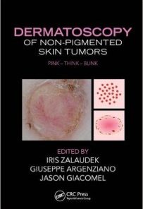 Dermatoscopy of Non-Pigmented Skin Tumors: Pink – Think – Blink