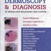 Dermoscopy and Diagnosis of Benign and Malignant Skin Lesions (EPUB) Dermoscopy and Diagnosis of Benign and Malignant Skin Lesions (EPUB)