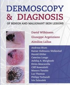 Dermoscopy and Diagnosis of Benign and Malignant Skin Lesions (EPUB)