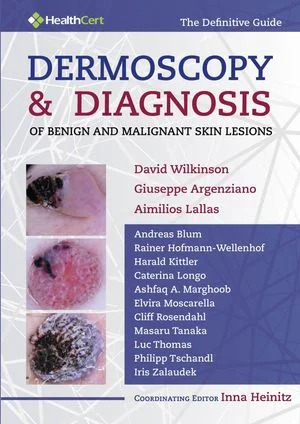 Dermoscopy and Diagnosis of Benign and Malignant Skin Lesions (EPUB) Dermoscopy and Diagnosis of Benign and Malignant Skin Lesions (EPUB)