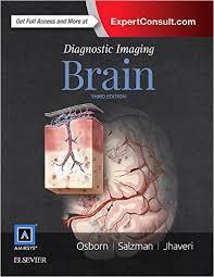 Diagnostic Imaging: Brain, 3e