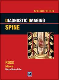 Diagnostic Imaging: Spine, 2nd Edition Published by Amirsys®, ed