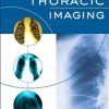 Diagnostic Thoracic Imaging