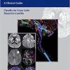 Diffusion Weighted and Diffusion Tensor Imaging: A Clinical Guide 1st Edition