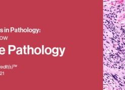 2021 Classic Lectures in Pathology: What You Need to Know: Soft Tissue Pathology (CME VIDEOS)