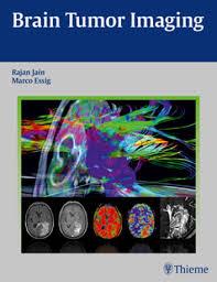 Ebook Brain Tumor Imaging