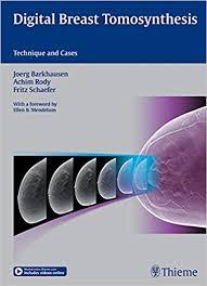 Ebook Digital Breast Tomosynthesis: Technique and Cases