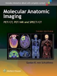 Ebook Molecular Anatomic Imaging: PET-CT and SPECT-CT Integrated Modality Imaging Edition 2