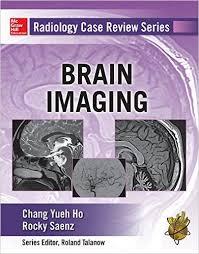 Ebook Radiology Case Review Series: Brain Imaging 1st Edition