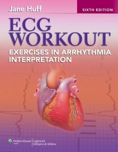 ECG Workout: Exercises in Arrhythmia Interpretation 6th Edition