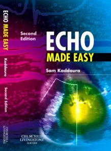 Echo Made Easy, 2nd Edition