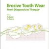 Erosive Tooth Wear: From Diagnosis to Therapy (Monographs in Oral Science, Vol. 25)