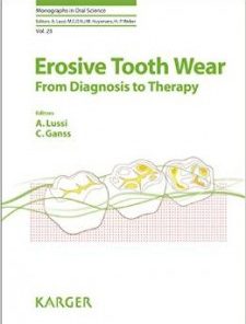 Erosive Tooth Wear: From Diagnosis to Therapy (Monographs in Oral Science, Vol. 25)