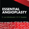 Essential Angioplasty