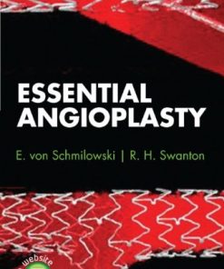 Essential Angioplasty