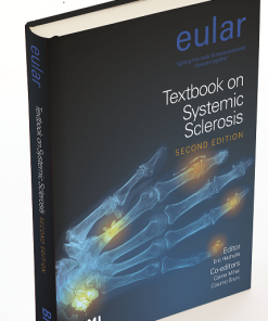 EULAR Textbook on Systemic Sclerosis (PDF)