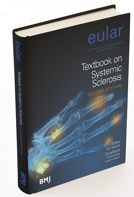 EULAR Textbook on Systemic Sclerosis (PDF) EULAR Textbook on Systemic Sclerosis (PDF)