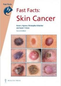 Fast Facts: Skin Cancer, 2e