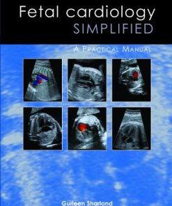 Fetal Cardiology Simplified: A Practical Manual