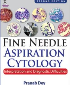 Fine Needle Aspiration Cytology : Interpretation and Diagnostic Difficulties, 2nd Edition