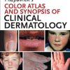 Fitzpatrick’s Color Atlas and Synopsis of Clinical Dermatology, 7th Edition (PDF)