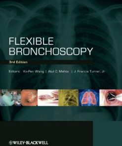 Flexible Bronchoscopy, 3e