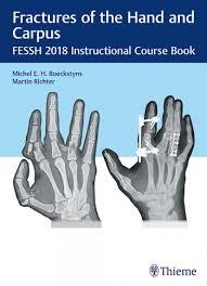 Fractures of the Hand and Carpus: FESSH 2018 Instructional Course Book