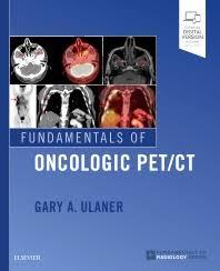 Fundamentals of Oncologic PET CT