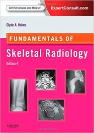 Fundamentals of Skeletal Radiology, 4th Edition Expert Consult: Online and Print