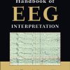 Handbook of EEG Interpretation, 2nd Edition