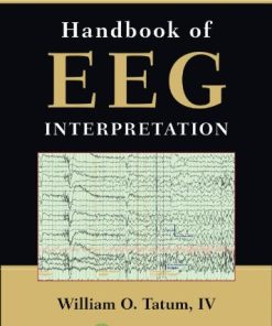 Handbook of EEG Interpretation, 2nd Edition