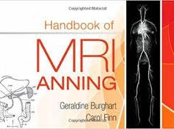 Handbook of MRI Scanning, 1e