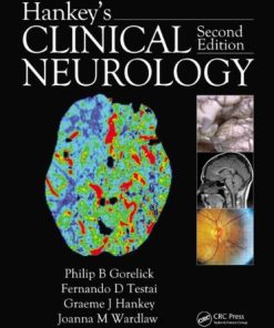 Hankey’s Clinical Neurology, Second Edition