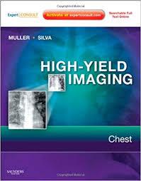 High-Yield Imaging: Chest: Expert Consult – Online and Print, 1e (HIGH YIELD in Radiology)