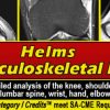 Helms Musculoskeletal MRI 2021 (CME VIDEOS)