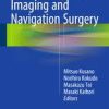 ICG Fluorescence Imaging and Navigation Surgery