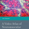 A Video Atlas of Neuromuscular Disorders