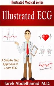 Illustrated ECG: A Step by Step Approach to ECG (Illustrated Medical Series) (EPUB)