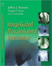 Image-Guided Musculoskeletal Intervention