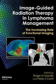 Image-Guided Radiation Therapy in Lymphoma Management: The Increasing Role of Functional Imaging