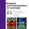 Imagerie post thérapeutique en oncologie