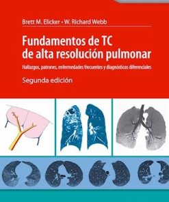 Fundamentos De Tc De Alta Resolucion Pulmonar Hallazgos, 2ª edición (High Quality Image PDF)