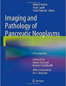 Imaging and Pathology of Pancreatic Neoplasms: A Pictorial Atlas